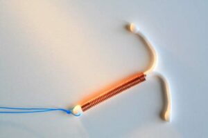 The essential about the copper Intrauterine device
