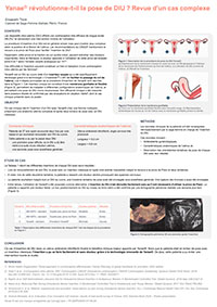 cemagcare-poster-uterus-anteverse